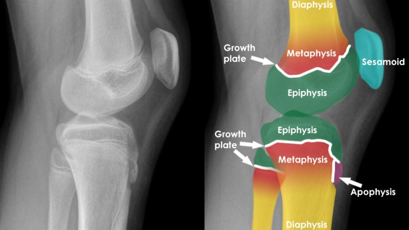 Epiphyseal Plate