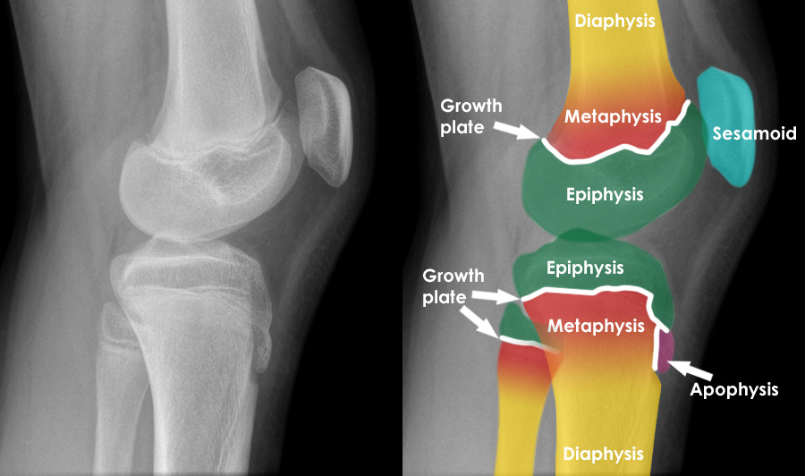 Epiphyseal Plate